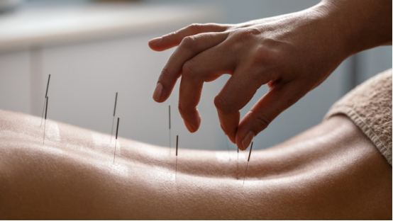 Acupuncture and Neuroscience: A Comprehensive Guide to Weight Loss and Vagus Nerve Regulation